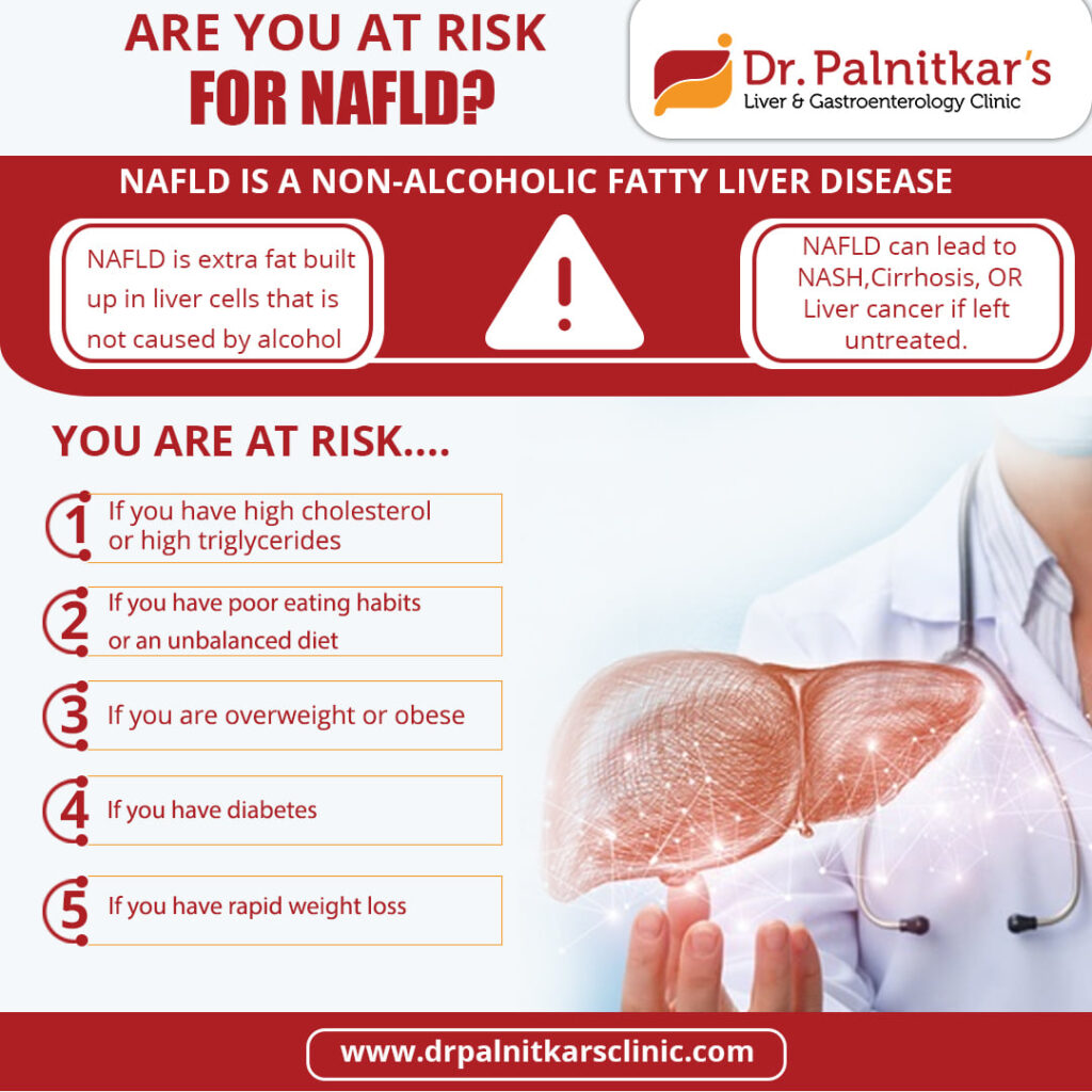 Are you at Risk for NAFLD?