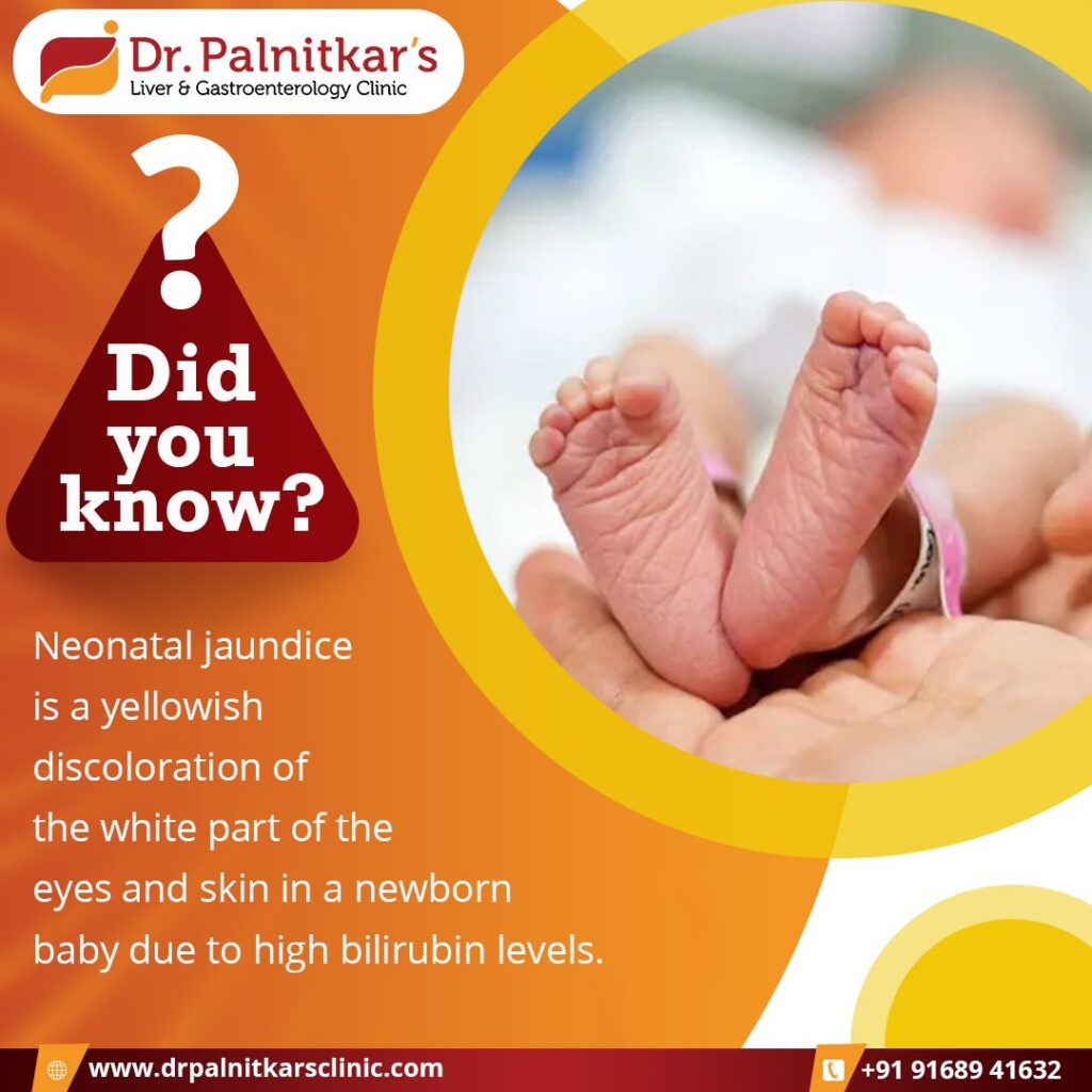 Did You Know? How is newborn jaundice treated…