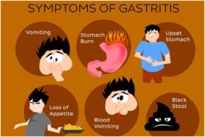  Gastroenterologist in Pune