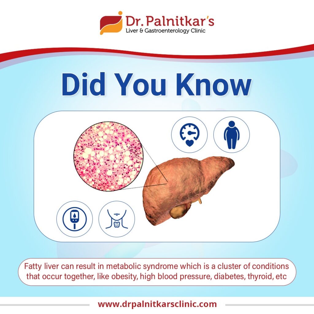 Did you know – Fatty liver can result in metabolic syndrome